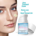 best pimple acne cream for face